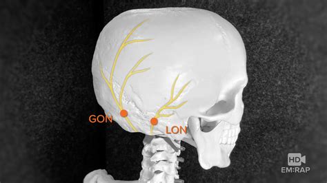 Cpt Code Occipital Nerve Block at Marcos Hines blog
