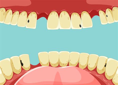 Does Vaping Stain Your Teeth? Unveiling the Truth