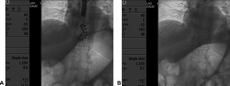 Image result for Linx Device