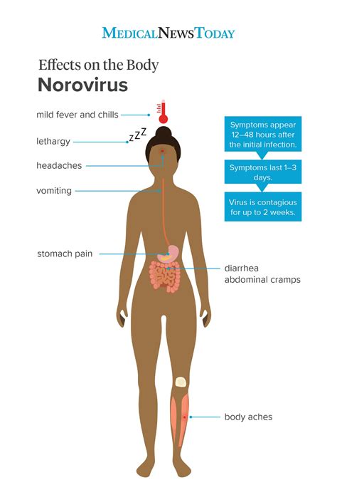 Norovirus: Symptoms, treatment, and prevention