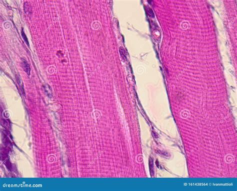 Non Striated Voluntary Muscle