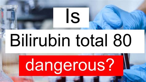 Is Serum Bilirubin total 80 high, normal or dangerous? What does Serum Bilirubin total level 80 ...