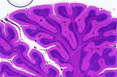 Image result for Brain Tissue Sample