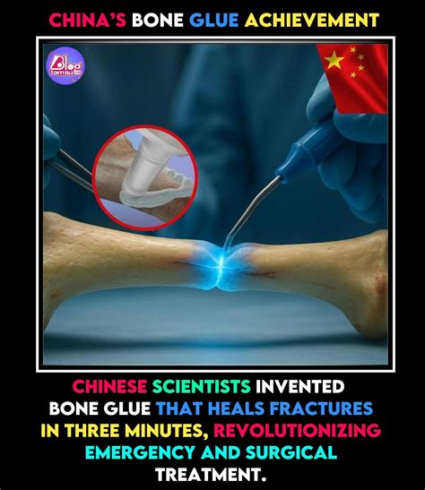 China’s Bone Glue “Bone-02” Promises Rapid Fracture Repair in Minutes ...