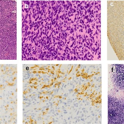 Spindle Shape 的图像结果