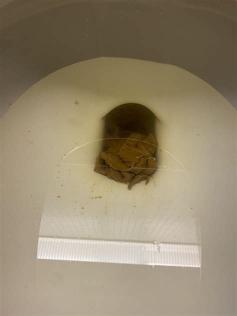 Extremely flat ribbon poop and now pencil thin pool for over 3 months, also a lot of mucus, also ...