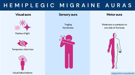 Familial Hemiplegic Migraine: 2023 Study Identifies 2 New Genes