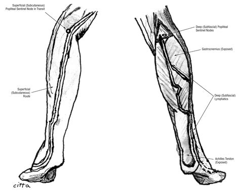Popliteal Lymph Nodes