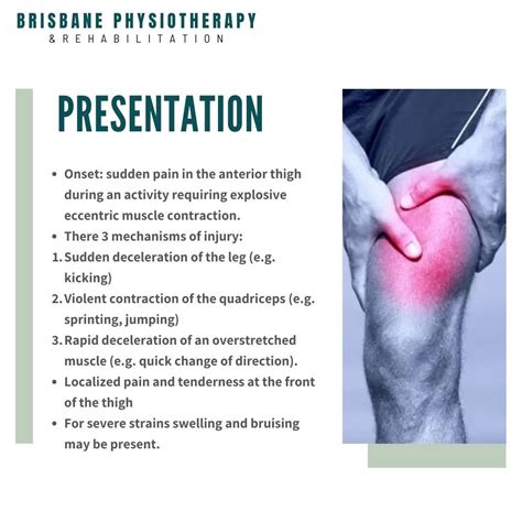What is a Quadricep Strain? - Brisbane Physiotherapy