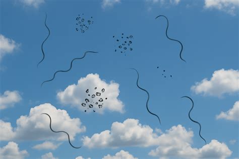 Eye Floaters: Causes, Symptoms, Treatment Options & Frequently Asked Questions - Anushka Super ...