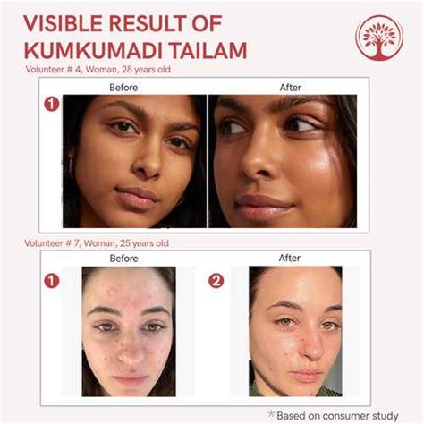 Buy Kumkumadi Tailam Oil - Ayurvedic Skin Rejuvenation