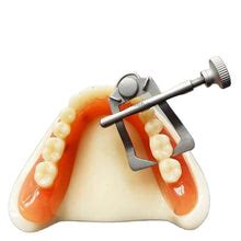 Anterior & Posterior Ivory Tooth Separator – Dentalmantraa
