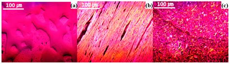 Effect of Particle Orientation and Porosity on Thermal Conductivity of ...