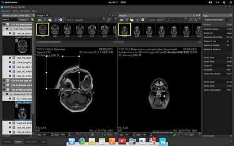 DICOM Query Retrieve Tool 的图像结果