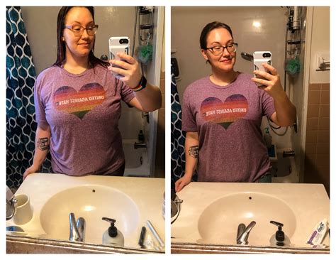 Breast Reduction Before And After Dd To C