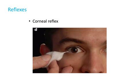 Trigeminal nerve cranial nerve | PPTX