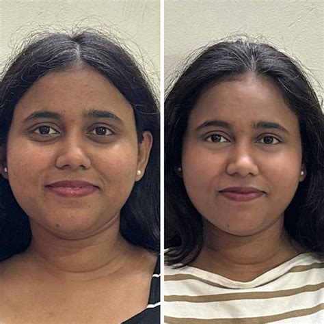 Buy Collagen Antioxidants Powder Orange Flavour | Bloom