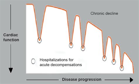 SciELO Brasil - Understanding Hospitalization in Patients with Heart ...