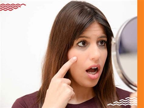 How to Treat Dark Circles: Causes, Tips & Remedies