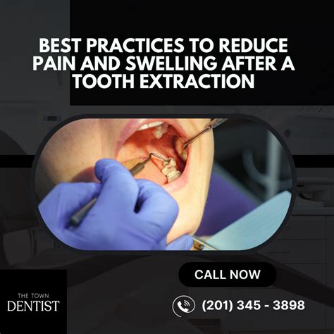 Best Practices to Reduce Pain and Swelling After a Tooth Extraction