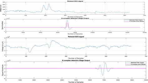 K-Complex 的图像结果