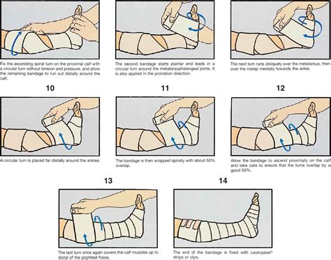 Image result for Applying a Compression Bandage