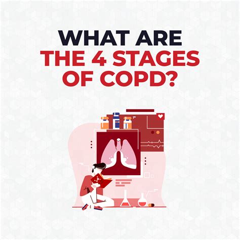 What are the 4 Stages of COPD? - CardiacDirect