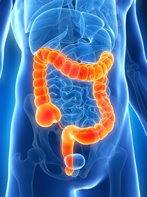 Enfermedades del intestino grueso | Enfermedades del colon ...