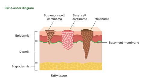 How a little red mole changed my life!