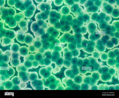 Image result for Bacteria Microscope Slides