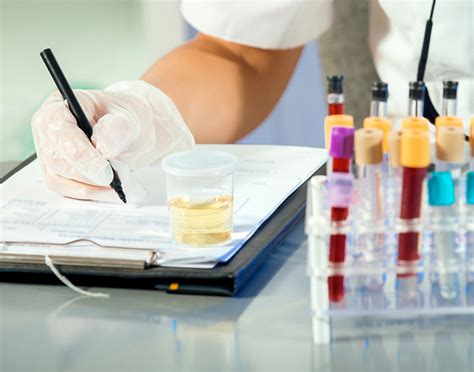 Myoglobin urine test