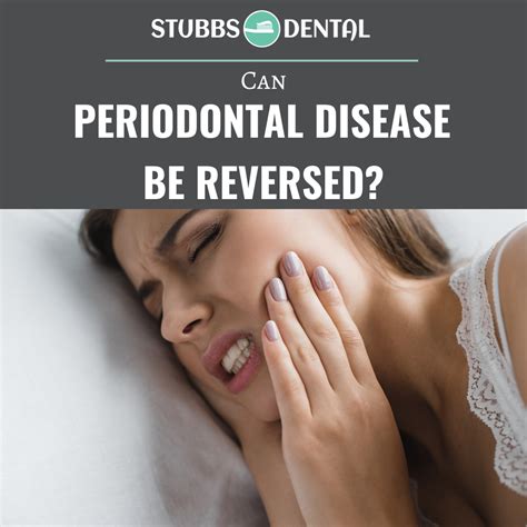 Can Periodontal Disease Be Reversed