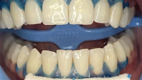 Crystal Smiles in Monona | Groupon