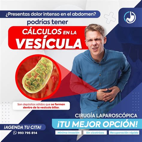 Cálculos en la Vesícula Biliar: Causas, Síntomas y Tratamiento – Doctor Pedro García