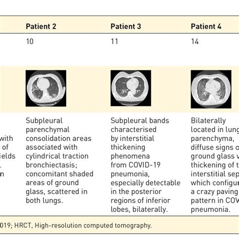 Image result for FiO2 2 LNC