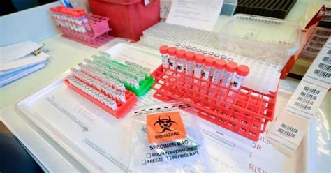 Two COVID-19 Testing Kits Can Check For Coronavirus In 10 Minutes, And ...