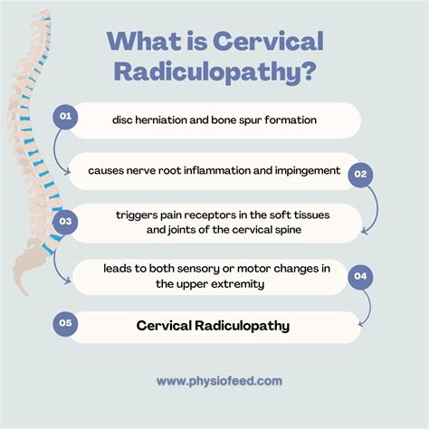 Physiotherapy for Cervical Radiculopathy: Techniques to Relieve Nerve Pain