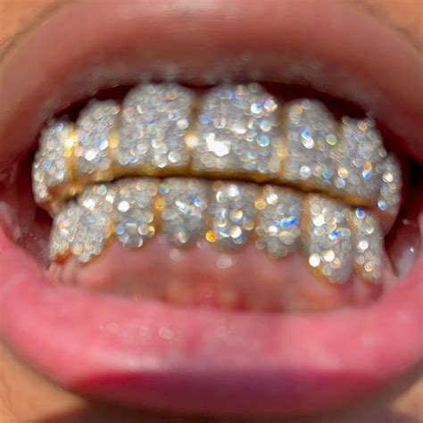 I Clarity Diamond Grill - Protective - White Gold / 18KT / 8 Top ...