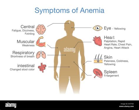 Anemia Symptoms Eye