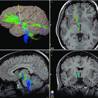 Image result for fMRI Python