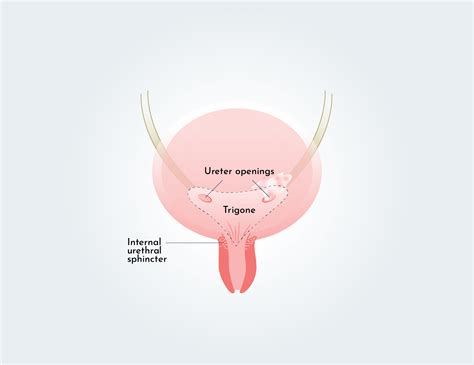 Fulguration Of Bladder