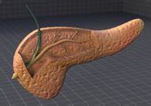 Pancreatic disorders surgery in chennai,Pancreatic disorders treatment ...
