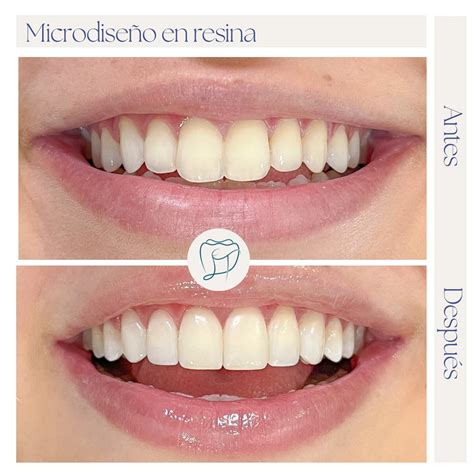 LET Dental Studio | English Speaking Dentist | 😬 No te cepillas después ...