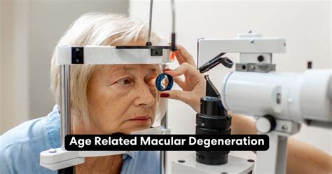 Image result for Macular Degeneration Vision Examples