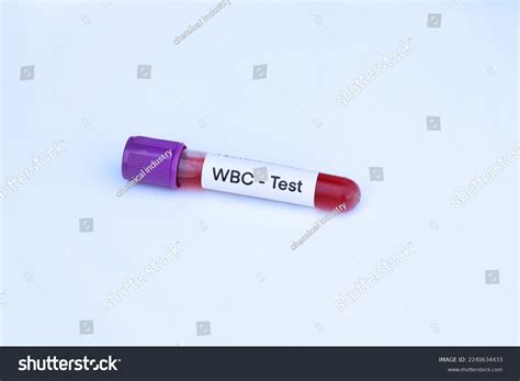 1,246 Wbc Test Images, Stock Photos & Vectors | Shutterstock