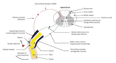 Hyperactive Reflexes 的图像结果