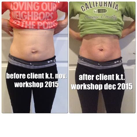 All New Before and After Pictures – Healing the Diastasis Recti 2015 – Beautiful After the Belly