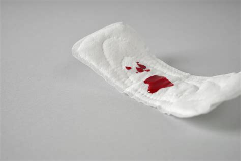 Can Blood Clots Be In Implantation Bleeding at Maggie Martinez blog