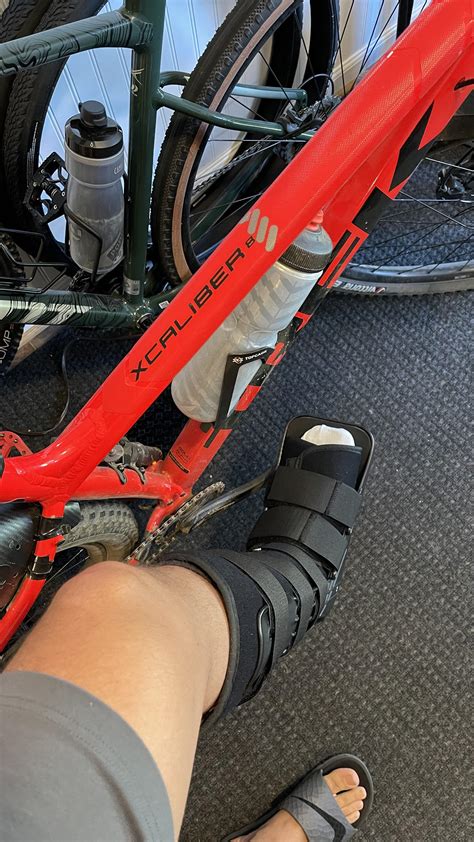 How to Treat Extensor Tendonitis Crepitus Reddit Boot: Effective Tips - My Style Grid