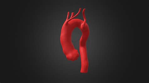 Right-Sided Aortic Arch with 4-Vessel Branch - 3D model by yuhuihuang [d1ac087] - Sketchfab